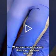 💔 My Wife Used to Trim My Nails... | A Story That Hits Hard