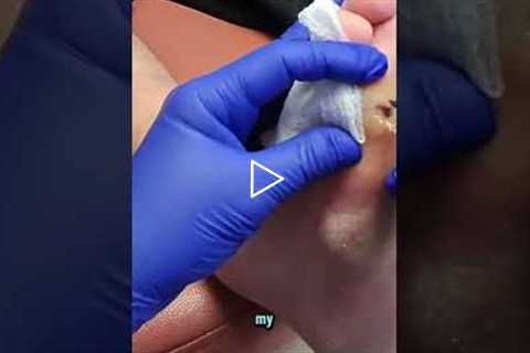 A Podiatrist Explains Seasonal Foot Pain
