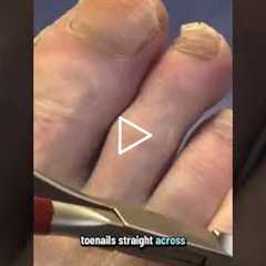 They say to cut toenails straight across, but I trim the edges
