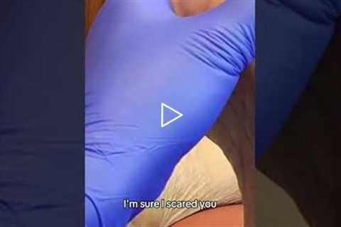 Unusual calluses A close look at a interesting foot condition