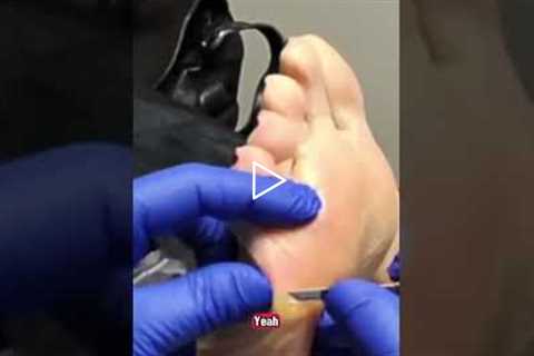 Will it ever go away: A skin problem or a pressure problem