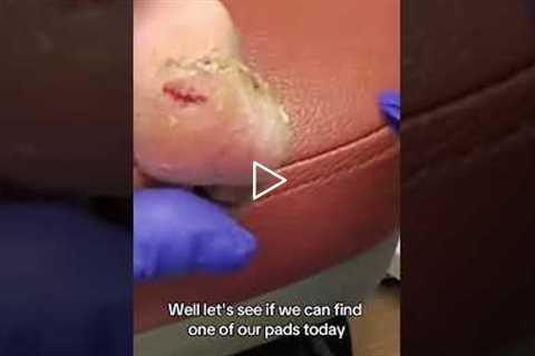 A Doctor’s First Step to Healing a Diabetic Wound 🩹🦶